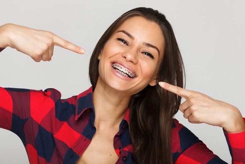 woman wearing braces smiling pointing to face