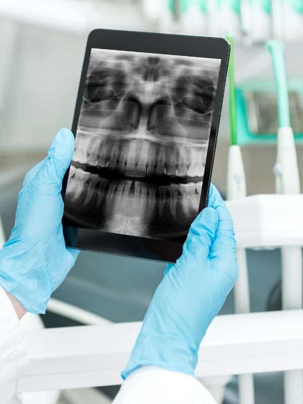 Exploring Digital Dental XRay Costs With Stellar Dental