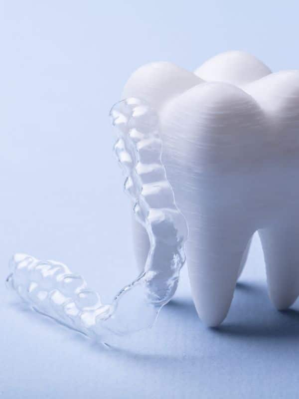 Clear Aligners laying up against a 3 dimensional tooth