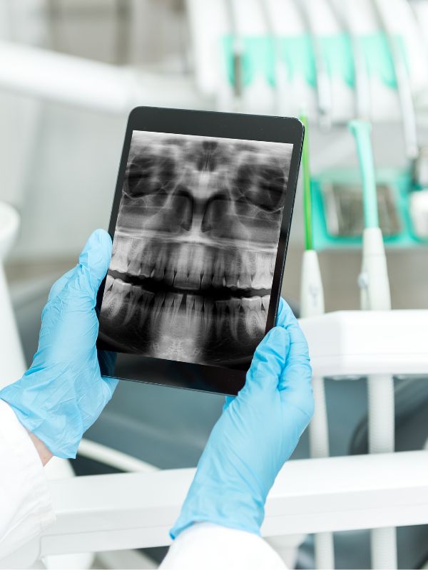 Dental X-Ray on ipad- larger size