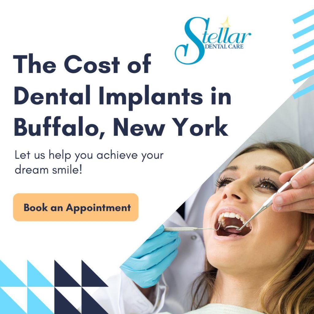 The Cost of Dental Implants in Buffalo, New York