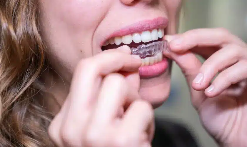 Transform Your Smile with Invisalign® Treatment at Stellar Dental Care