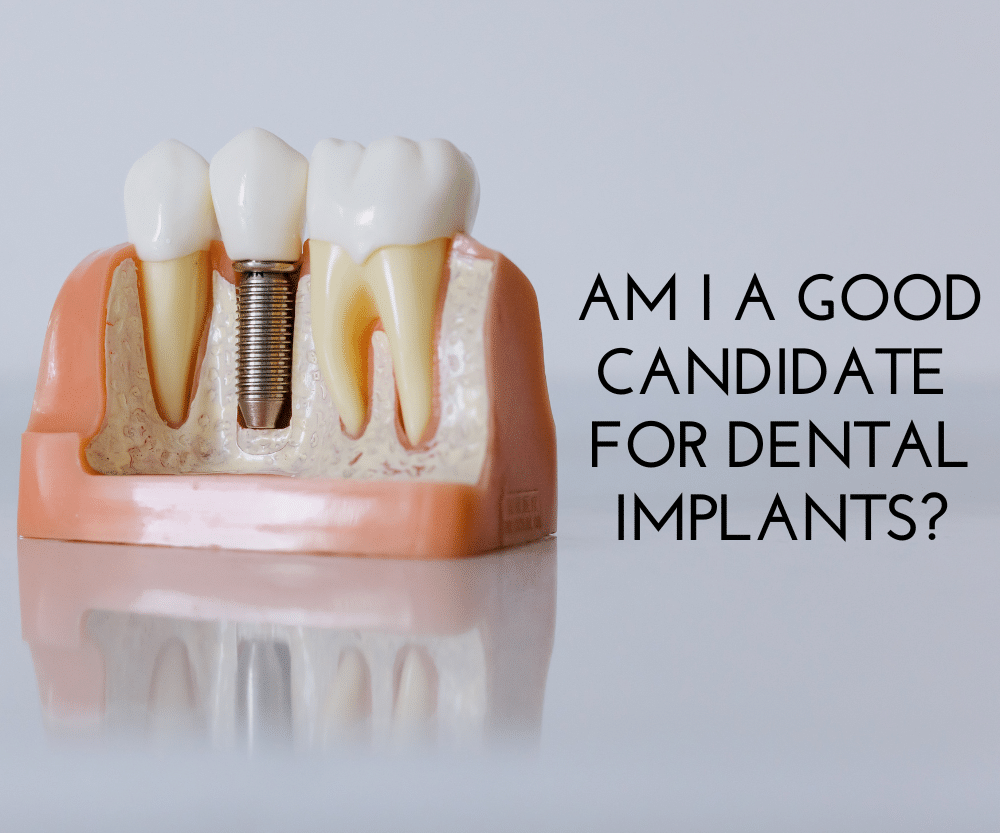 The ideal candidate for dental implants