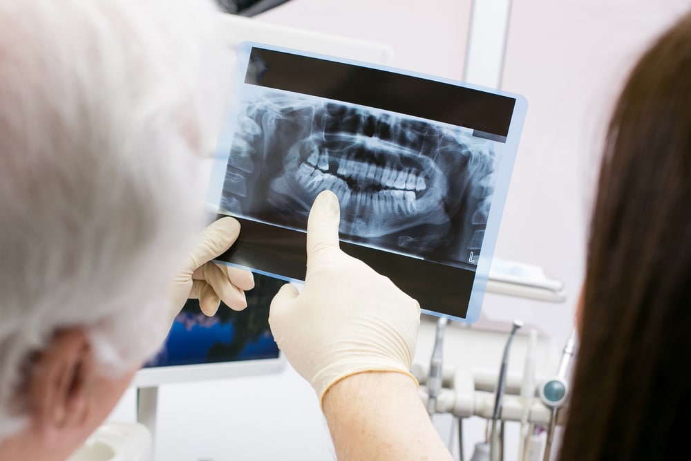 Learning All about Dental X Rays A Kid Friendly Guide