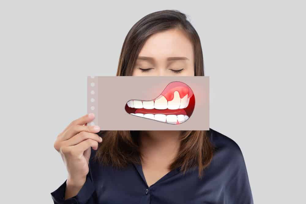 Preventing Gum Disease Simple Tips for Healthy Gums