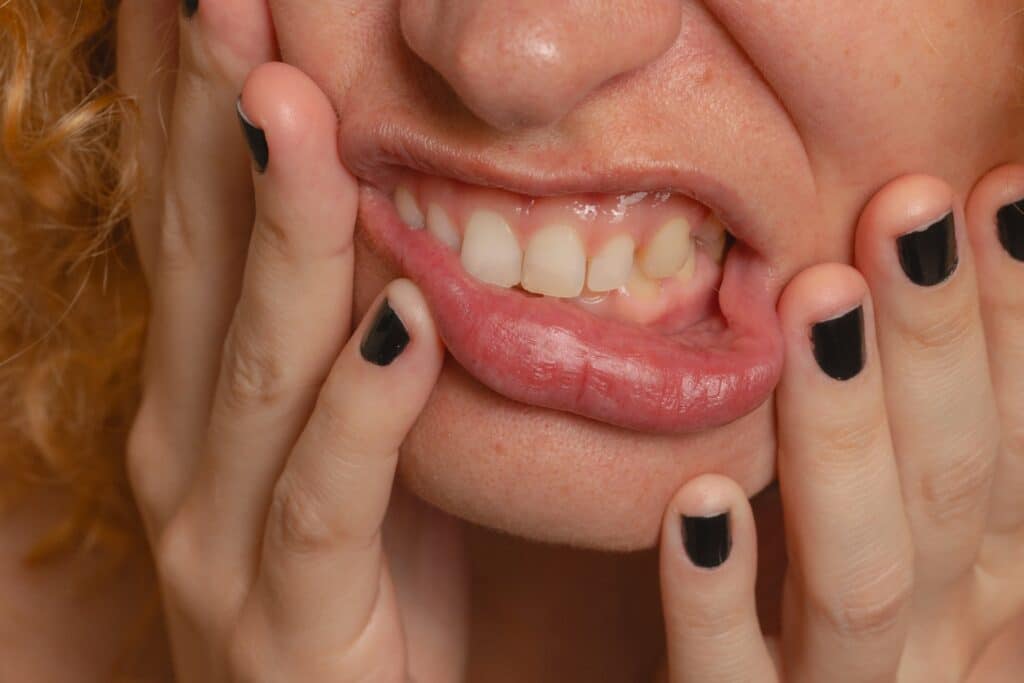 periodontal disease