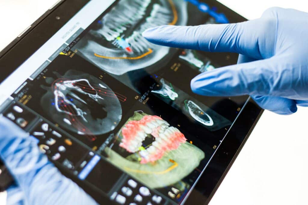 Dental X-Rays