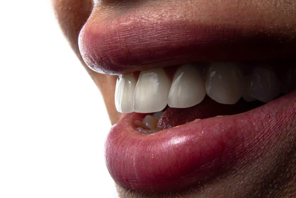 uneven teeth