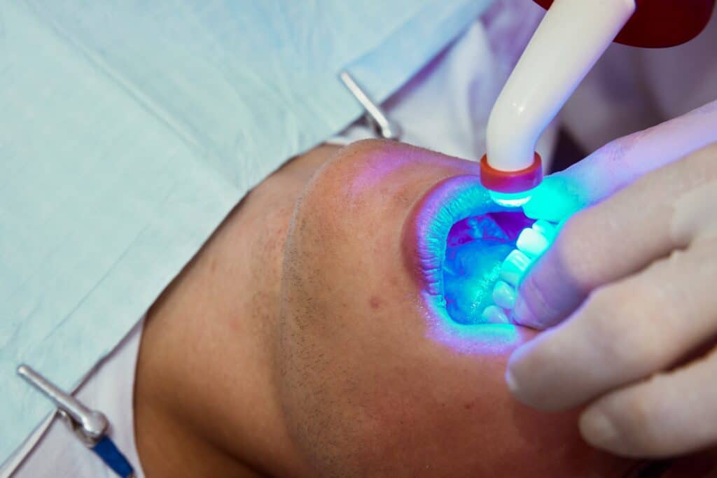 Teeth Whitening