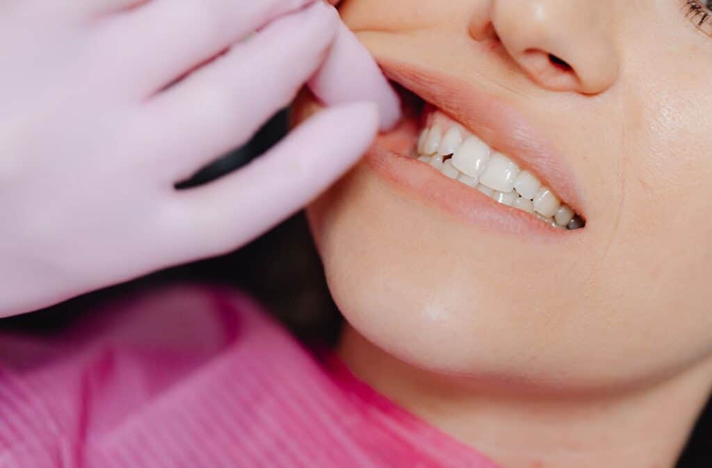 dental crown